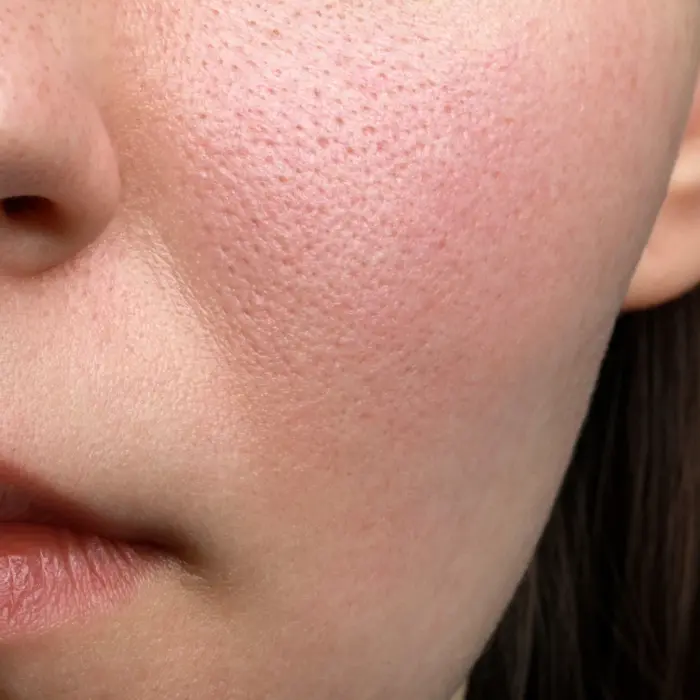 肌のキメやなめらかさを求める女性